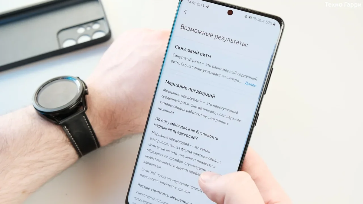 Galaxy Watch 3 - новые функции: измерение ЭКГ и давление | Техно Гарри |  Дзен