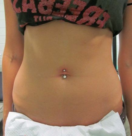 Пирсинг пупка.