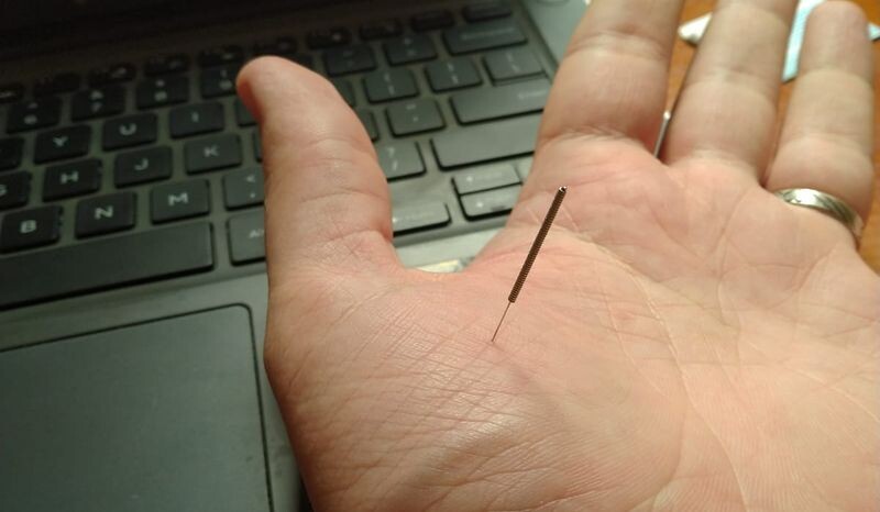 Су Джок терапия, фото автора