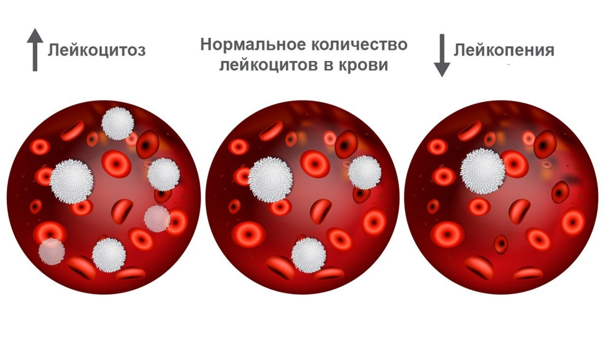 Изменение количества лейкоцитов в крови