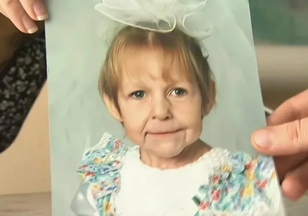 Старый человек маленький. Трогательные снимки. Старый человек маленький. Прогерия (синдром хатчинсона–гилфорда). Человечность фото.