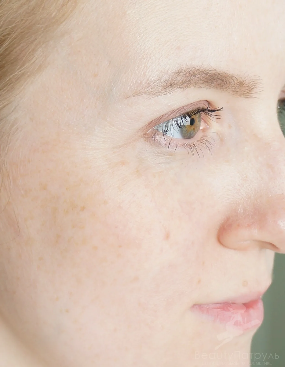 Очень тонкая сухая кожа. Очень тонкая сухая кожа. Очень тонкая сухая кожа. Очень тонкая сухая кожа. Очень тонкая сухая кожа.