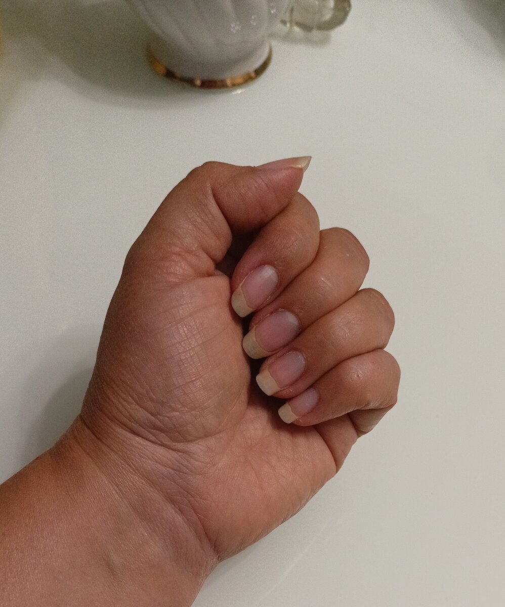 Растет сам по себе , изредка красится .