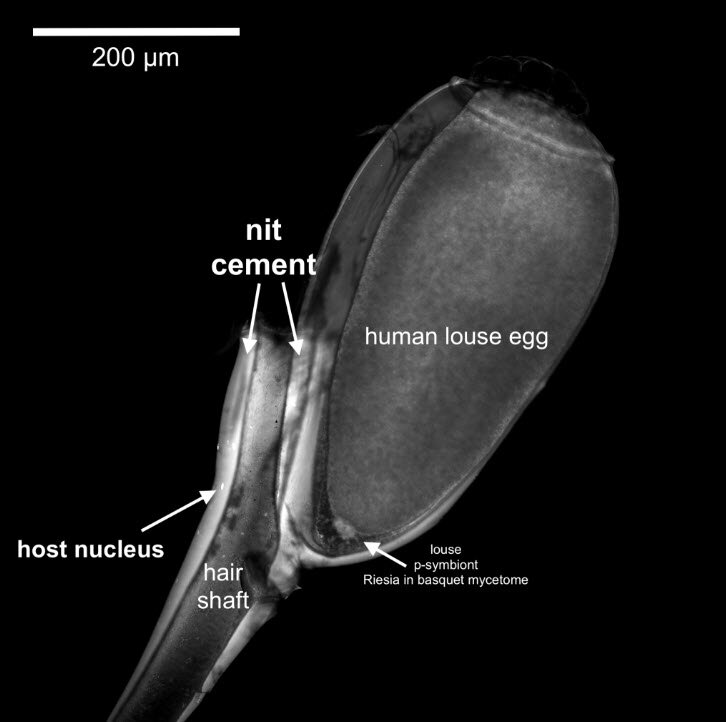Цемент от вшей склеивает ядра человека и сохраняет их во времени