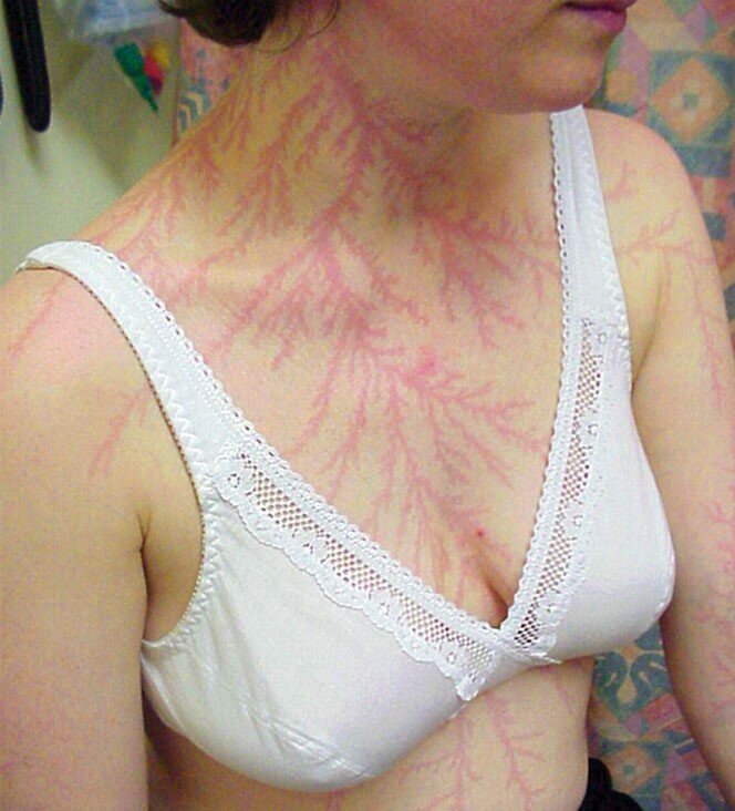 «Фигура Лихтенберга». Фото взято из Яндекс.картинки для иллюстрации