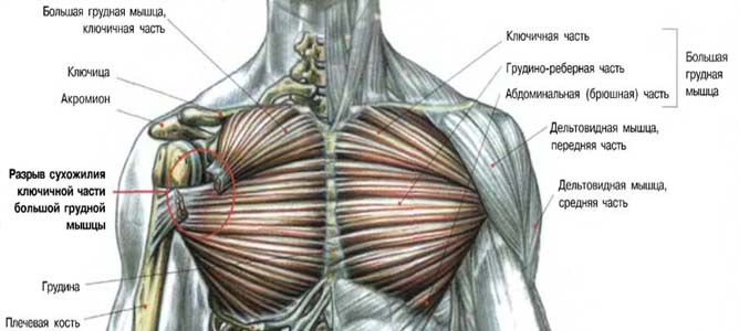 Резкое опускание локтей вниз или слишком сильное опускание локтей ниже уровней плеча может приводить к надрыву и даже разрыву большой грудной мышцы.