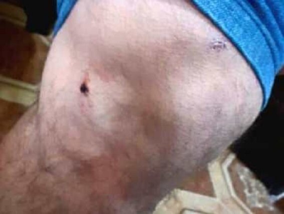 Срочно! На территории общины Гетаван Нагорного Карабаха азербайджанцы применили насилие в отношении армянской молодежи. ФОТО