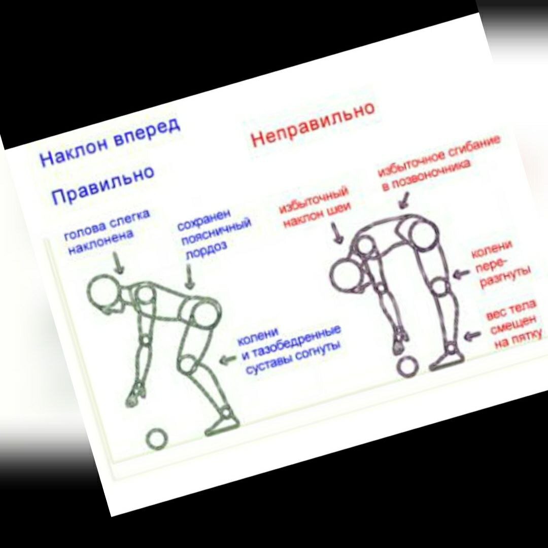 Остеопороз. Болит спина, болят кости и суставы в Санкт-Петербурге