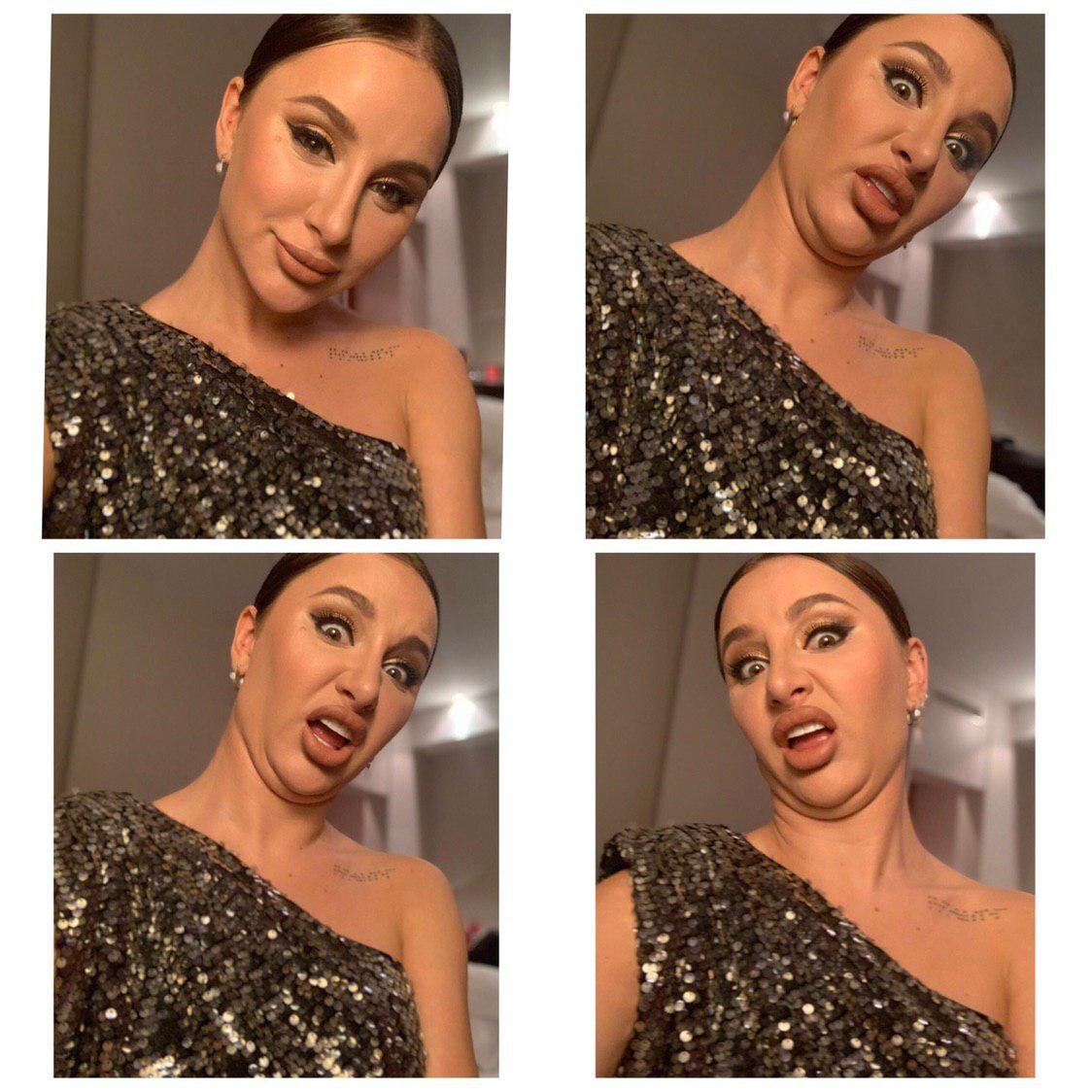 Певица асти до пластики. Асти до и после. Асти до и после. Асти новый имидж. Асти до и после.