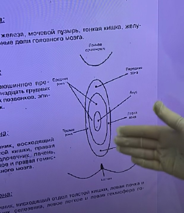 Как вылечить геморрой