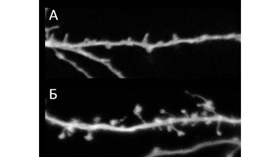 Фото: Пресс-служба СПбПУ📷Микрофотографии дендритного фрагмента нейрона гиппокампа мыши. А — в условиях амилоидной токсичности контакты, формируемые выростами (шипиками) на теле дендрита, разрушены. Б — тестируемый препарат в концентрации 100 нМ в присутствии амилоидной токсичности восстанавливает структуру шипиков, увеличивая число контактов между нейронами