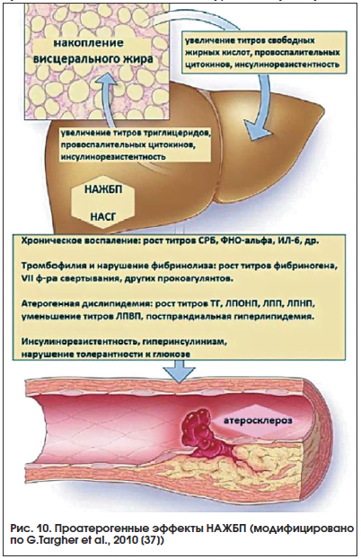 Каковы признаки жирового гепатоза?