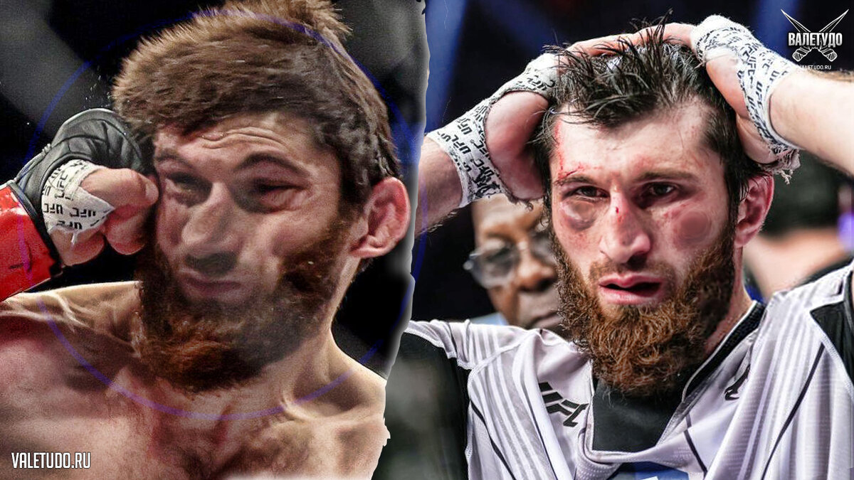 Магомед Анкалаев пропускает удар | valetudo.ru 