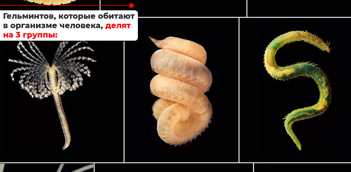 Кто и как долго живёт внутри нас: нематоды, цестоды, трематоды ...