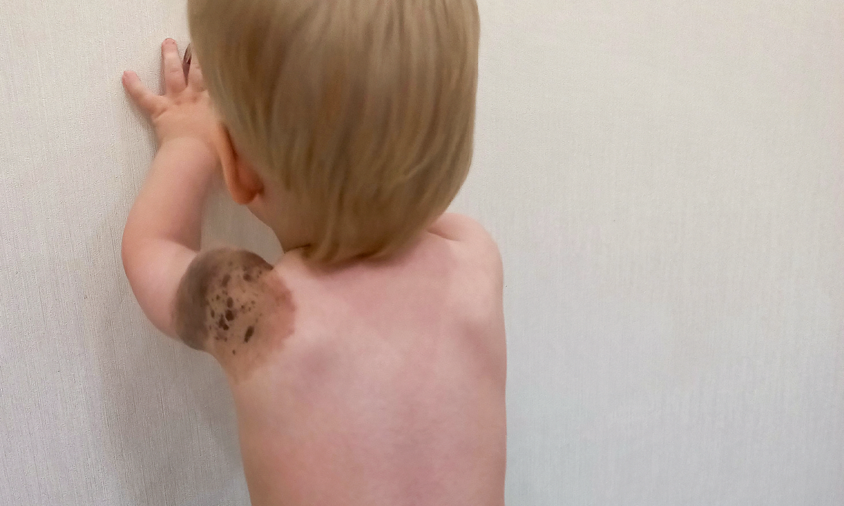 Марк Сивко, подопечный фонда "Алёша"