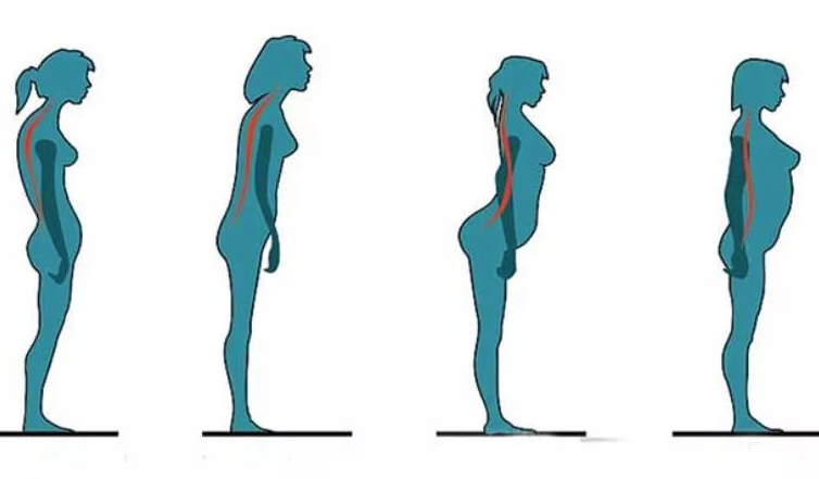 Это фото я уже размещала в своей статье об осанке. Оно лучше всего показывает прямую зависимость живота от положения спины