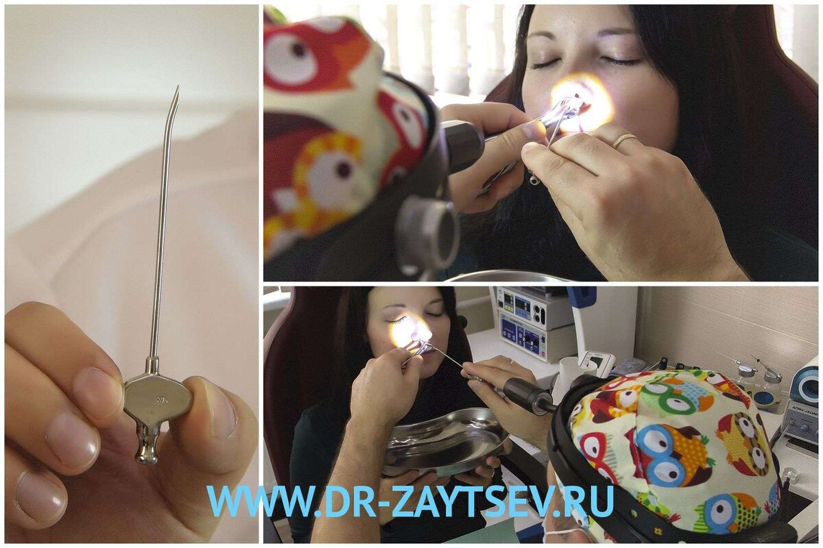 Кандидат медицинских наук Владимир Зайцев ведет прием в своей клинике