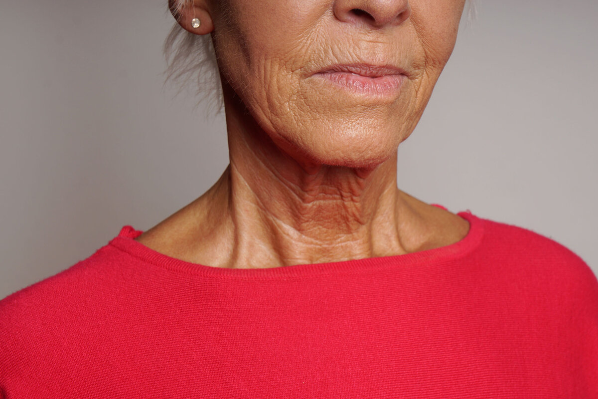 шея 40 лет фото женщины