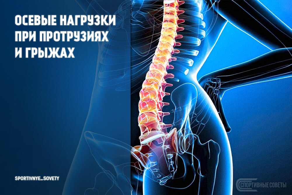 Какой врач лечит протрузии позвоночника