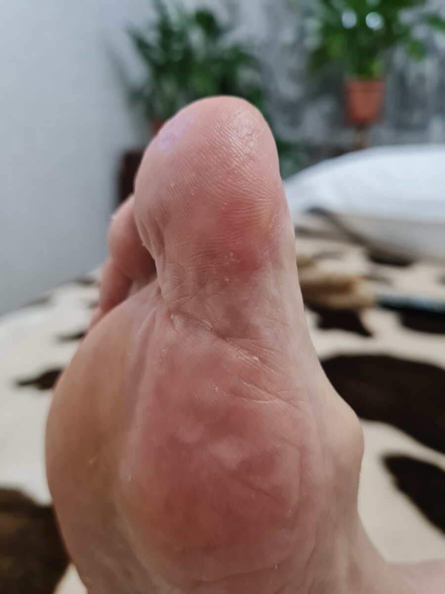 Сразу после (без крема, только почистила и смыла состав )