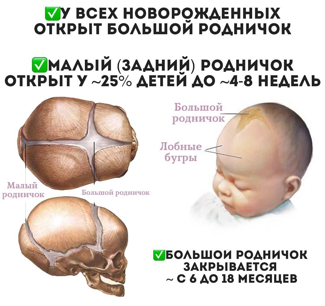 что такое родничок