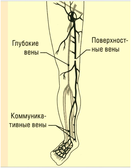 Лечение стволового варикоза