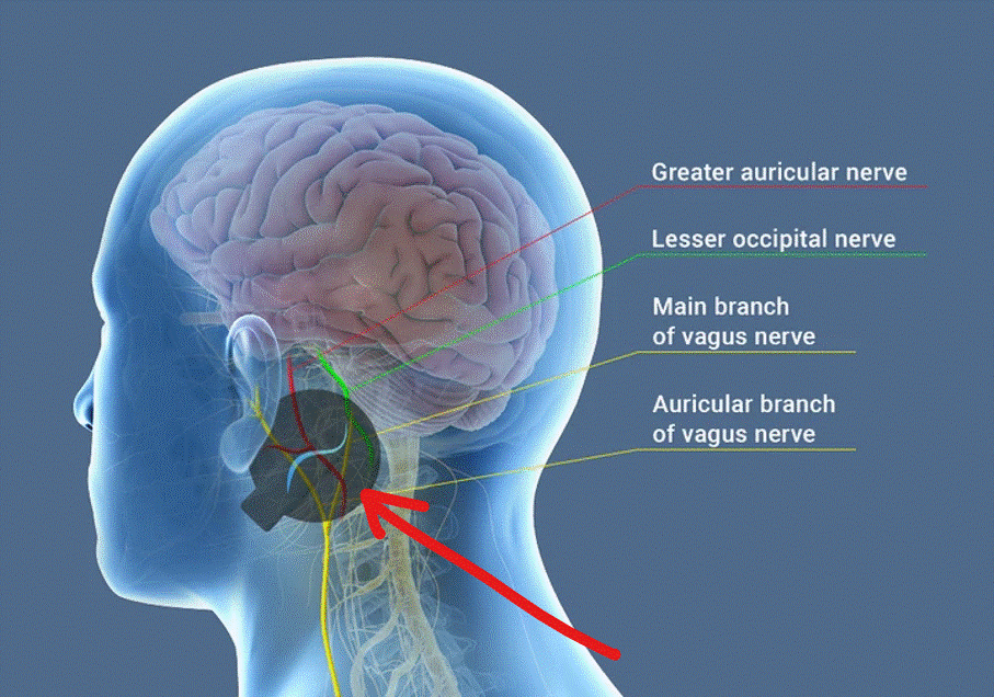 Чрезкожный нейростимулятор схема через