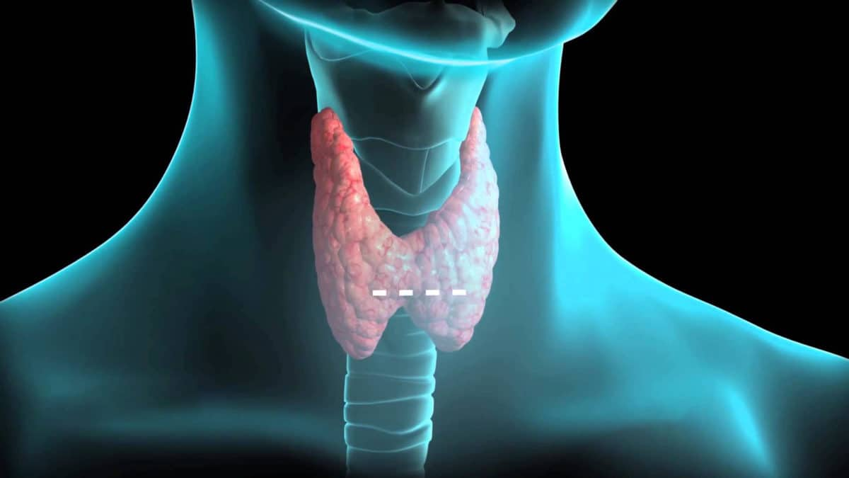 Психосоматика щитовидки. Анатомия щитовидной железы 3д. Thyroid щитовидная железа. Опухшая щитовидная железа.