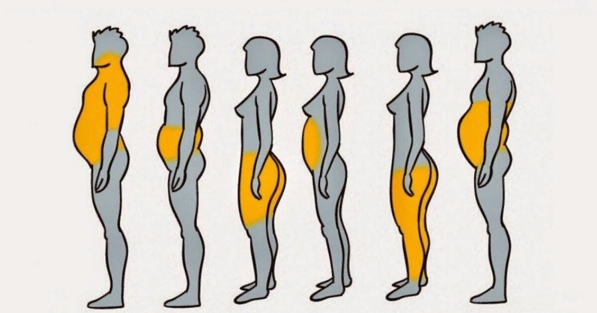 Почему откладывается жир у женщины. Подкожный и висцеральный жир. Почему откладывается жир у женщины. Что откладывается в жир. Жир у девушек.
