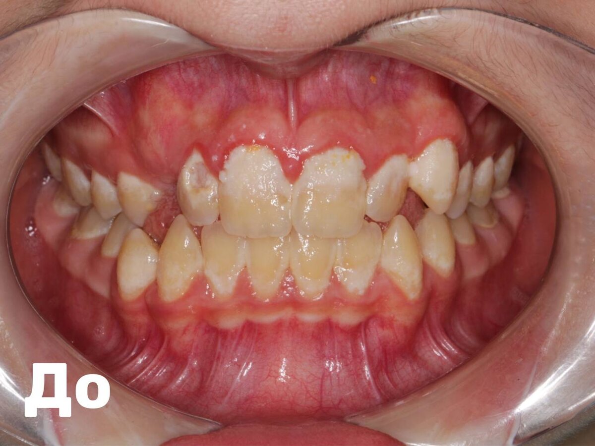 До чего может довести плохая гигиена