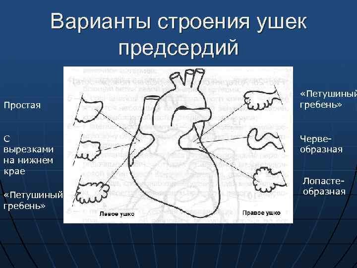 Уши сердца. Строение правого предсердия. Варианты строения ушка предсердия.