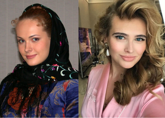 Анна горшкова до и после пластики Пластика разделила их жизнь на ДО и ПОСЛЕ: 5 русских актрис, которые обратились 