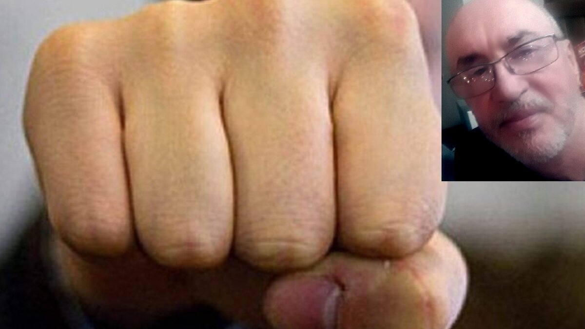 Лицо на фото перенесло челюстно-лицевую операцию по выравниванию перегородок и костей носа. Потом лицо поумнело и научилось себя защищать.