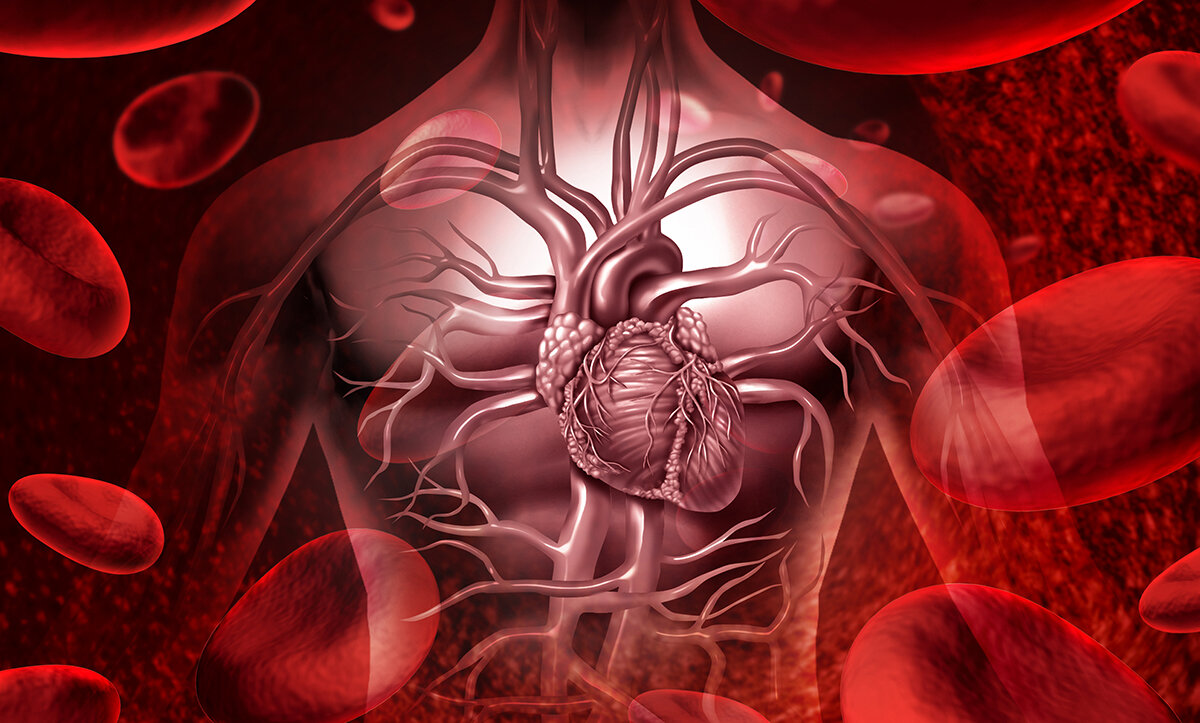 Что такое инфаркт миокарда