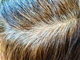 Седина (собст.фото)