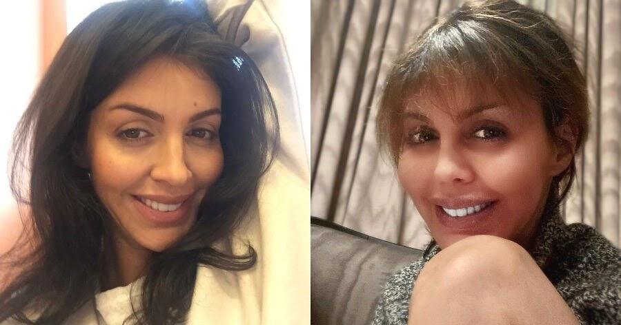 Алиса после операции. Алиса казьмина сейчас. Журналистка алиса казьмина. Алиса после операции. Алиса аршавина.