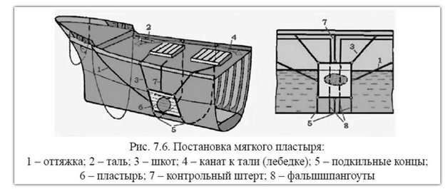 схема заводки пластыря из учебника. чтобы имели представление те, кто не видел, как это делается.