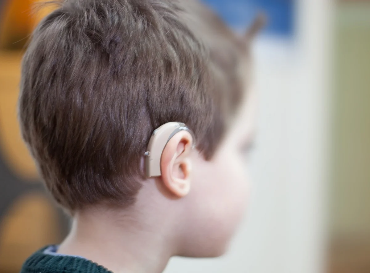 Слабовидящие слабослышащие дети. Аппарат Cochlear кохлеарный Cochlear. Слуховой аппарат кохлеарный имплант. Слуховой аппарат для детей. Слуховые аппараты для слабослышащих детей.