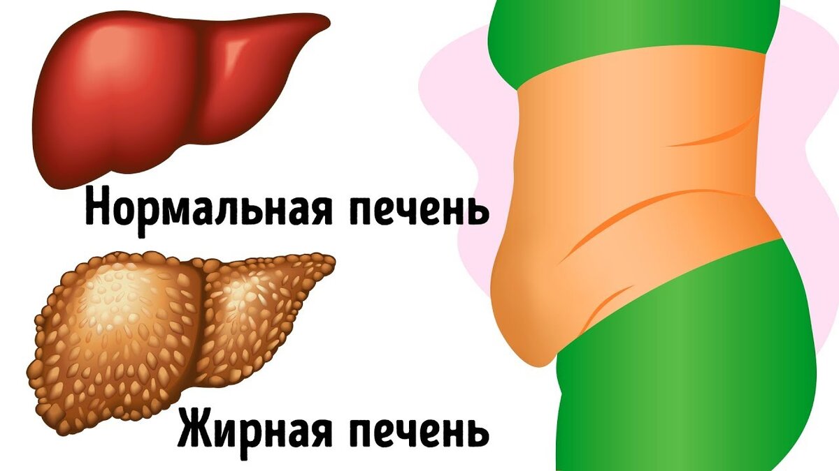 ГРЯЗНУЮ ПЕЧЕНЬ ОЧИСТИ ОДНИМ РАСТЕНИЕМ