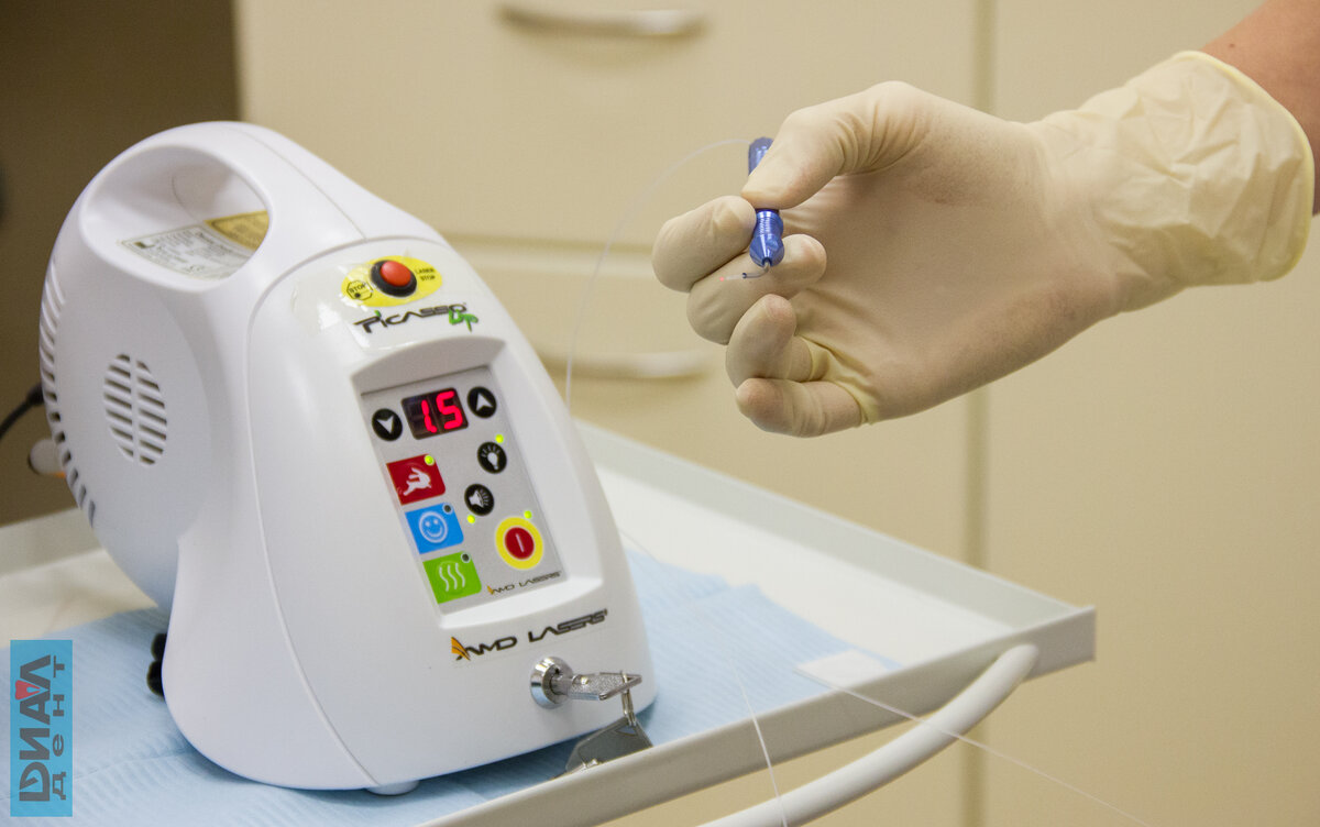 лазер в стоматологии применяется после удаления зубов для ускорения заживления