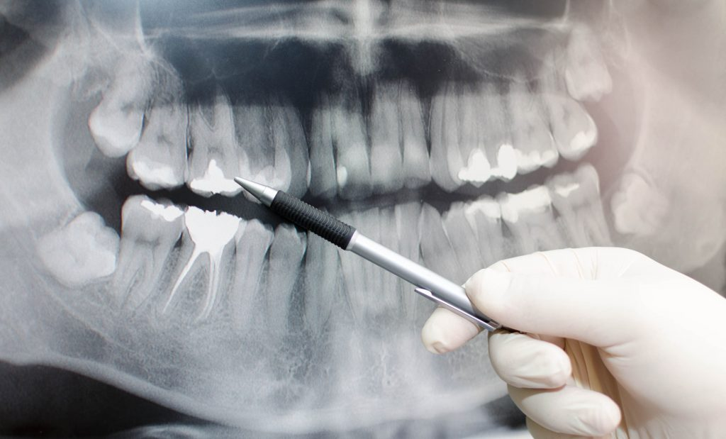 Яндекс.картинки