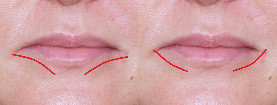 На первом фото показала, в каких местах губы поджимаются, на втором обозначила, что именно в этих местах нужно прорисовать контур, чуть выезжая за естественный