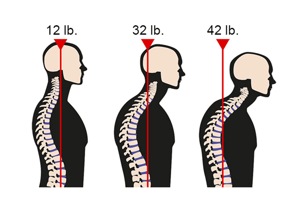 https://milamhealth.com/forward-head-posture-fix-review/