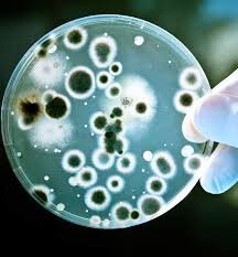 Колонии бактерий, растущие в чашке Петри на питательный среде. 