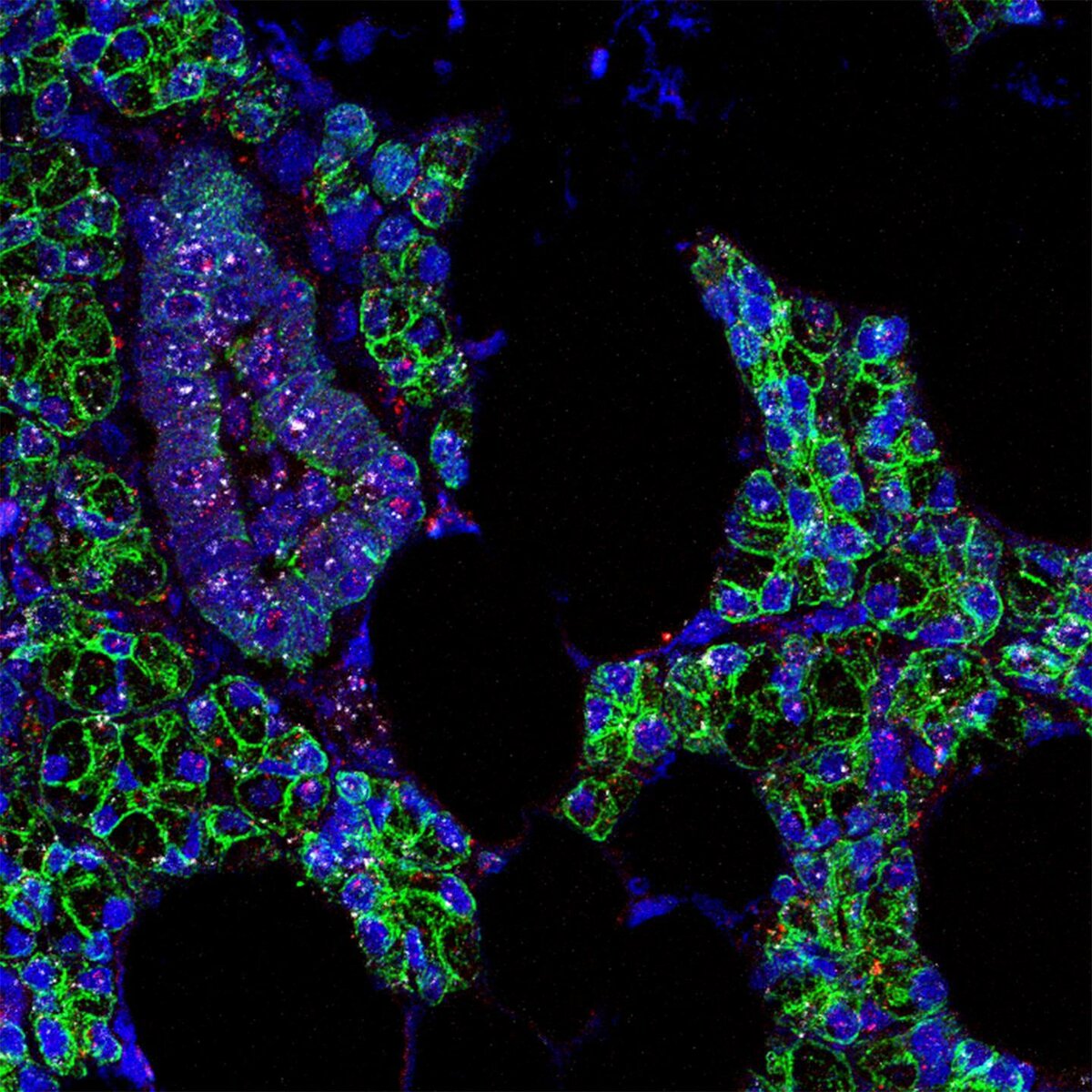 Фото выше показывает РНК SARS-CoV-2 (розовые) и рецепторы ACE-2 (белые), которые были обнаружены в клетках слюнных желез человека (зелёные). Изображение Paola Perez, NIDCR.