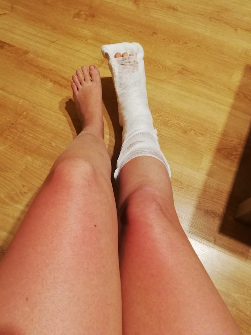 Год назад я близко познакомилась с польской медициной, когда вывихнула ногу