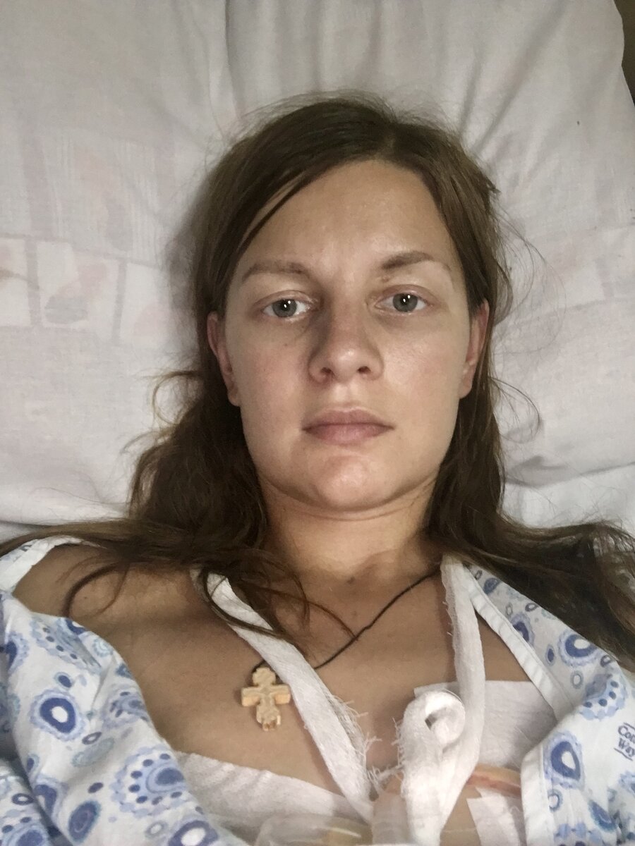 Под пластырями то, что осталось от моей груди