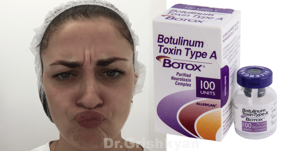 Ботулинотерапия препаратом Botox. Фото с сайта Д.Р. Гришкяна. Имеются противопоказания, требуется консультация специалиста