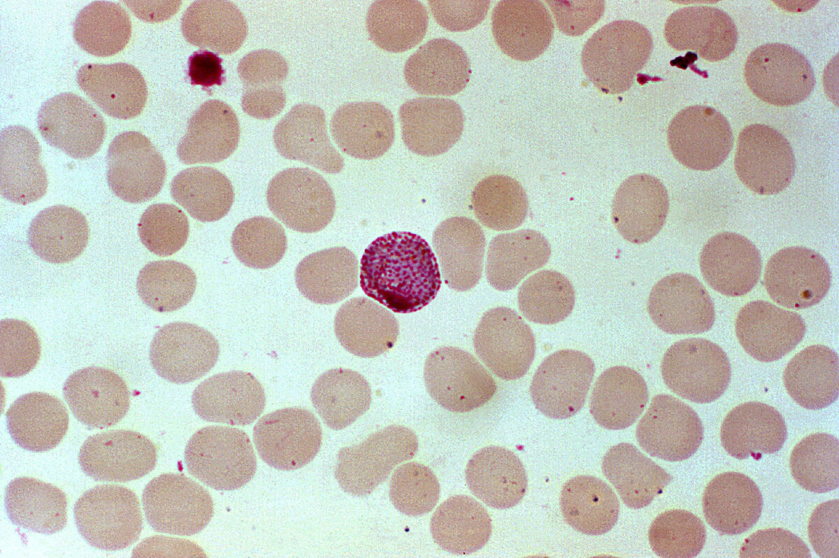 Паразит малярии. Малярийный плазмодий Вивакс. Plasmodium (p. Vivax, p. ovale, p. malariae, p. falciparum). Plasmodium Vivax возбудитель. Малярийный плазмодий Plasmodium Vivax.