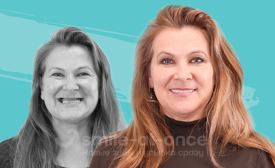 Фото пациентов клиники Smile-at-Once до и после установки комфортных протезов. Беззубая жизнь позади! Фото: Smile-at-Once.ru.